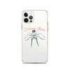 Forensic Jawns iPhone Case